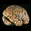 Picture of brain